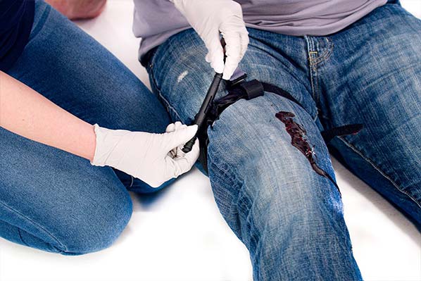 PLACING A TOURNIQUET